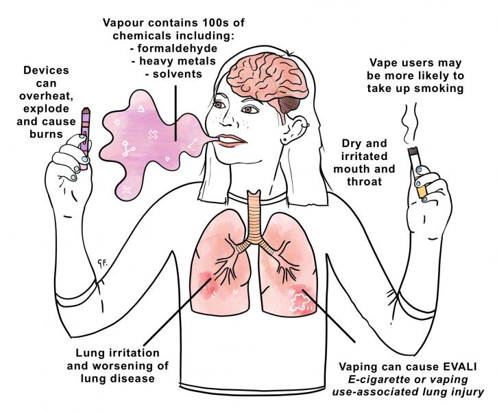 Vaping Young People KidsHealth NZ